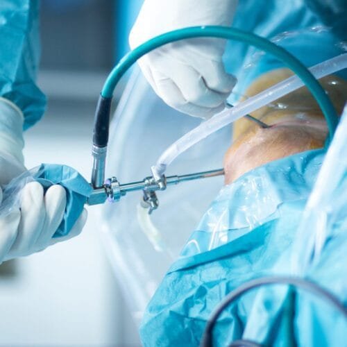 Αρθροσκοπική Αποκατάσταση Βλαβών Αρθρικού Χόνδρου
